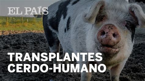 Los órganos De Cerdos Serán Trasplantados En Humanos Materia Youtube