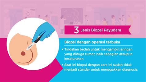 Mitos Dan Fakta Tentang Biopsi Kanker Payudara Youtube