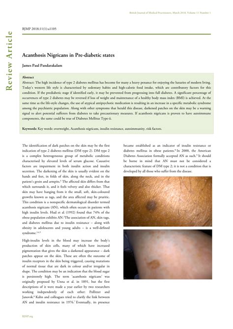 Pdf Acanthosis Nigricans In Pre Diabetic States