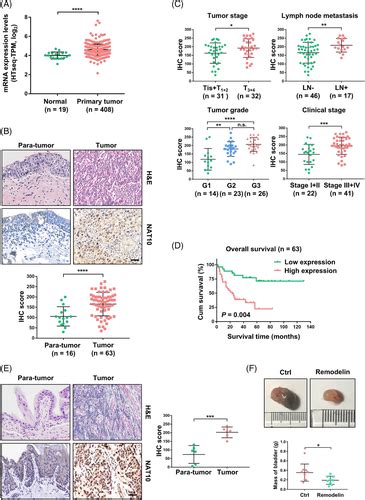 Nat10‐mediated Mrna N4‐acetylcytidine Modification Promotes Bladder