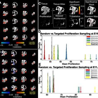 voxel based morphometry   embryo heads  statistical