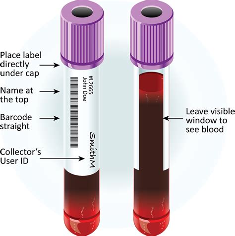 Fundamental Principle of Clinical Specimen Collection - Microbiology Notes