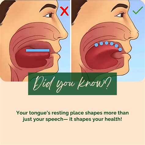 Best 13 Tongue Tie Release Exercises – Artofit