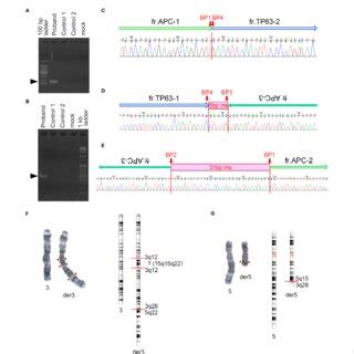 Sanger Sequencing Around Presumed Breakpoints In APC And TP63 And