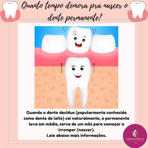 Quanto Tempo Demora Pra Nascer O Dente Permanente