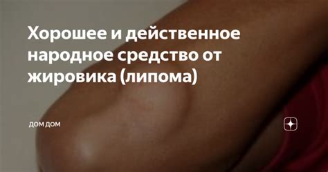 Хорошее и действенное народное средство от жировика (липома) Здравств ...