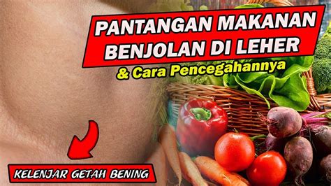 Pantangan Makanan Bagi Penderita Penyakit Benjolan Kelenjar Getah