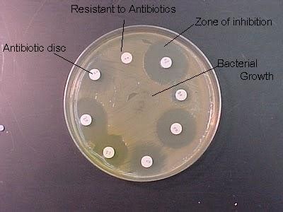 Chapter 7 The Control Of Microbial Growth Flashcards Quizlet