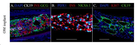 Immunostaining Of Donor Cell Derived Tissue In Om Implants Of The Nude
