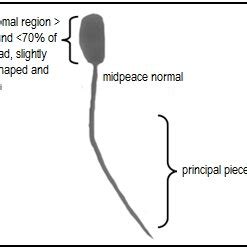 Normal Sperm Morphology. | Download Scientific Diagram