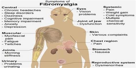 Fibromyalgia Symptoms Diagnosis And Treatment Assignment Point