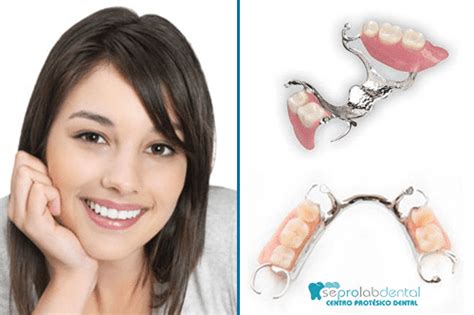 Pr Tesis Dentales Sin Ganchos Ni Paladar Seprolab Dental