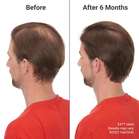 Ext Extreme Hair Therapy Artofit