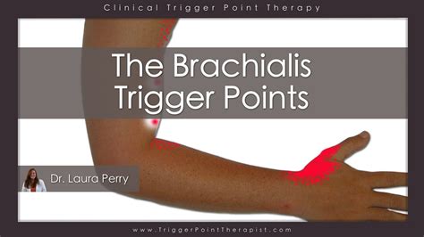 The Brachialis Trigger Points - YouTube