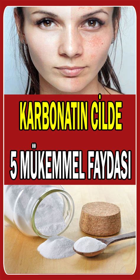 Karbonat N Cilde M Kemmel Faydas Karbonat Cilt Bak M Il