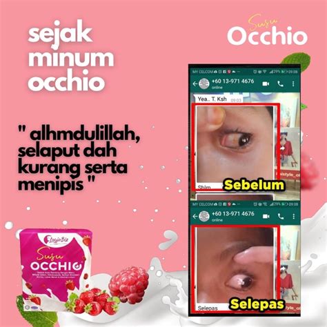 Susu Occhio Ready Stok Hilangkan Masalah Rabun Silau Selaput Mata