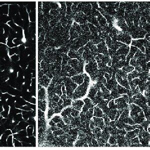 Deterioration Of Two Photon Microscopy Signal With Imaging Depth A