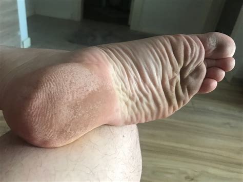 My Soles And Ass Pics Xhamster