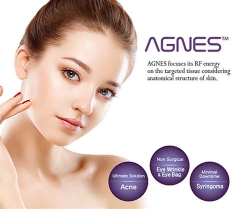 AGNES Acne Laser Treatment | Skin Care Clinic Los Angeles