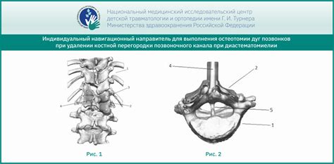 В НМИЦ им. Г. И. Турнера создали уникальный навигационный направитель ...