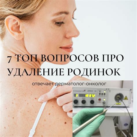 7 ТОП вопросов про удаление родинок лазером - Клиника «ЛИЦ ...