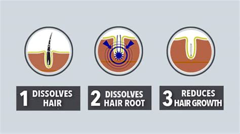 Armpit hair - How to Get Rid of it Permanently | Hairfree Official Site