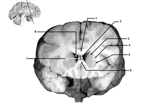 coronal slice diagram quizlet