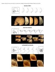 Images To Help With Scoring Of Skull Traits For Sex Estimation Pdf Images To Help With