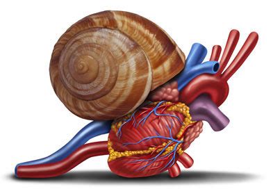 Insuffisance Cardiaque Cartes Quizlet