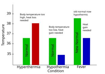 fever wikipedia