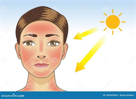 Skin Cancer From Sun Exposure