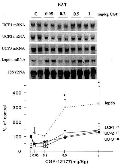 Northern Blotting Analysis Of MRNAs For UCP1 UCP2 UCP3 And Leptin In