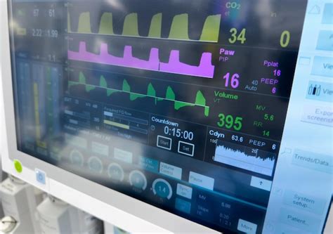 premium photo hospital monitor displaying vital signs emphasizing