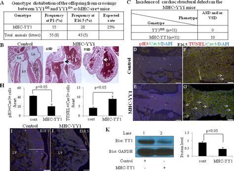 Critical Role Of Yy1 In Cardiac Morphogenesis Beketaev 2015