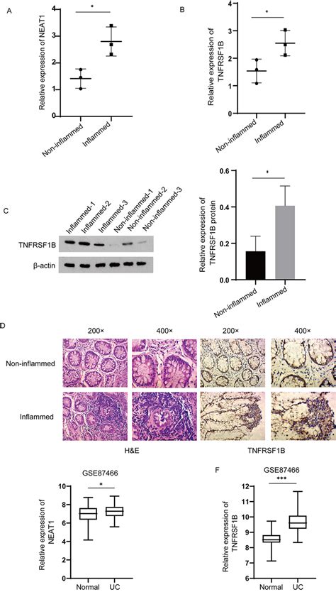 Expression Of NEAT1 TNFRSF1B In The Lesion And Adjacent Site Of UC