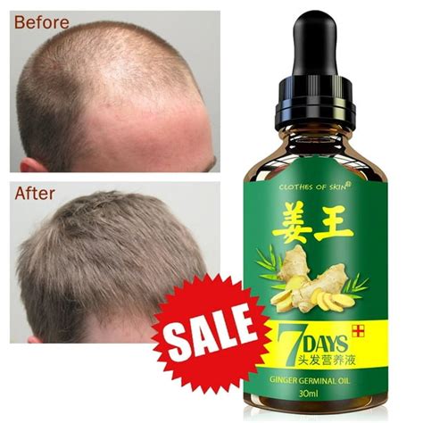 Regrow 7 Day Ginger Germinal Hair Growth Serum Hairdressing Oil Loss Treatments 1 Pack