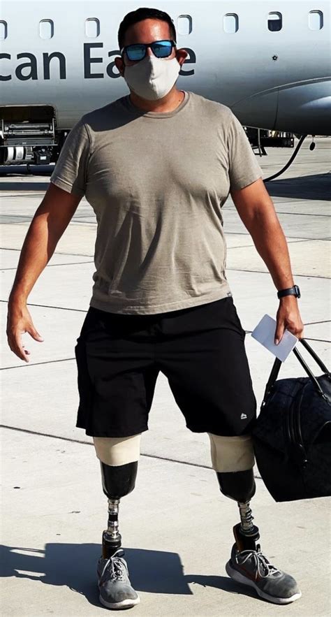 Gay Amputee Fetichism And Others