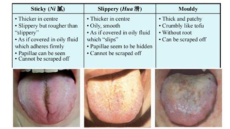 Weird Tongue Texture