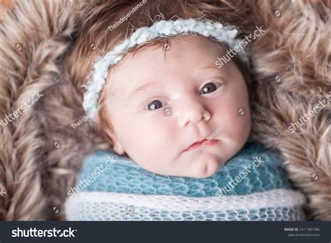 Cleft Chin Baby
