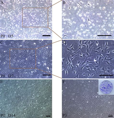 Morphology Of Adherent Cells Under Hypoxic Culture Conditions O