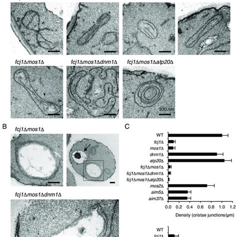 Ultrastructural Analysis Of Mitochondria A B Electron Micrographs