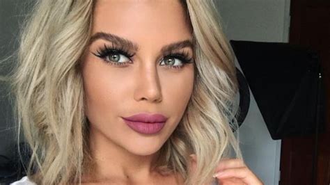 Big Brother Contestant Skye Wheatleys Boob Job Nightmare The Chronicle