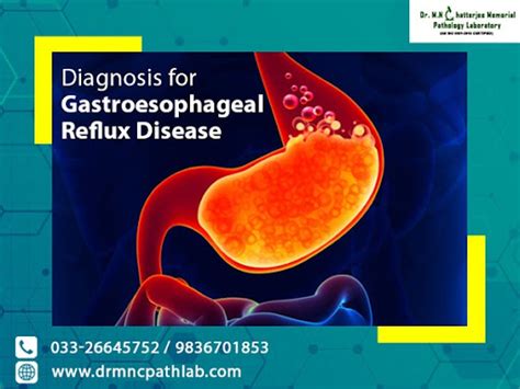 Pictures Of Acid Reflux Damage To Throat