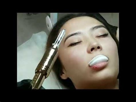 Увеличение губ на Гиалурон Пэн Hyaluron pen - YouTube