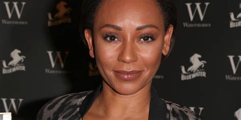 Mel B Wears Eyepatch After Temporarily Going Blind From Reported Herpes