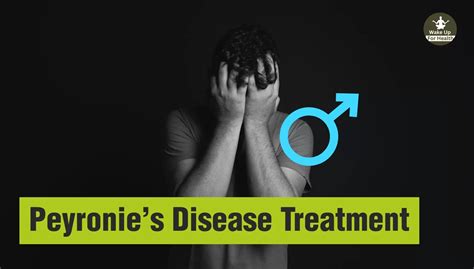 Peyronies Disease Management Understanding Symptoms And Treatment