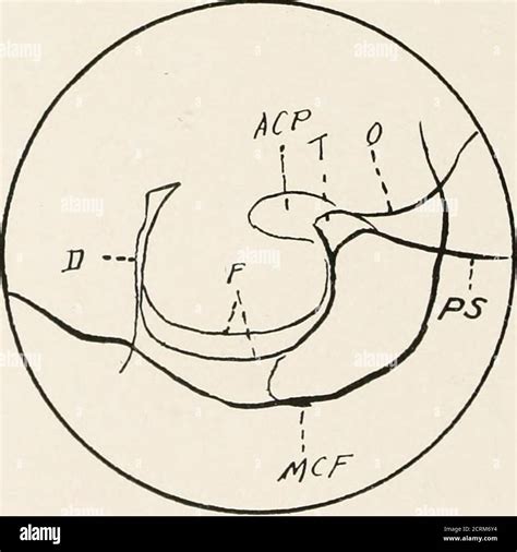 Roentgen Diagnosis Of Diseases Of The Head Fig 55 A