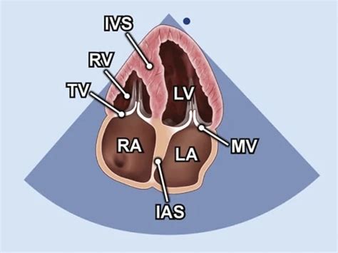 Pocus Cardiac Views Cardio Guide