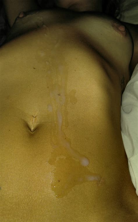 Skin Yellow Joint Back Shoulder Porn Pic