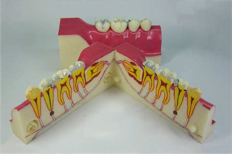 Buy Educational Model Decomposition Model Of Right Lower Ior Teeth